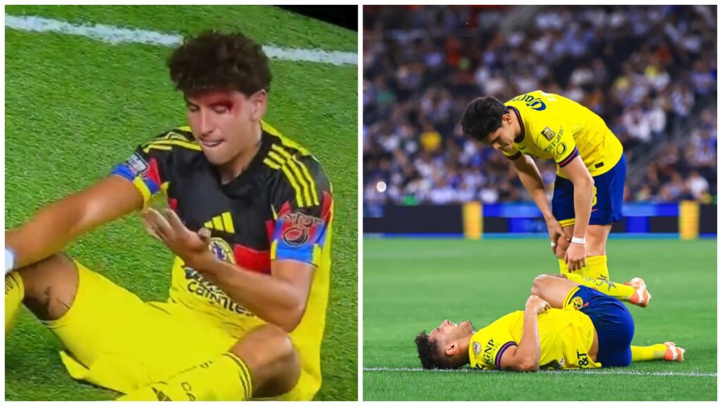 Nueva lesión de Sebastián Cáceres y duro golpe a Igor Lichnovsky. Imago7