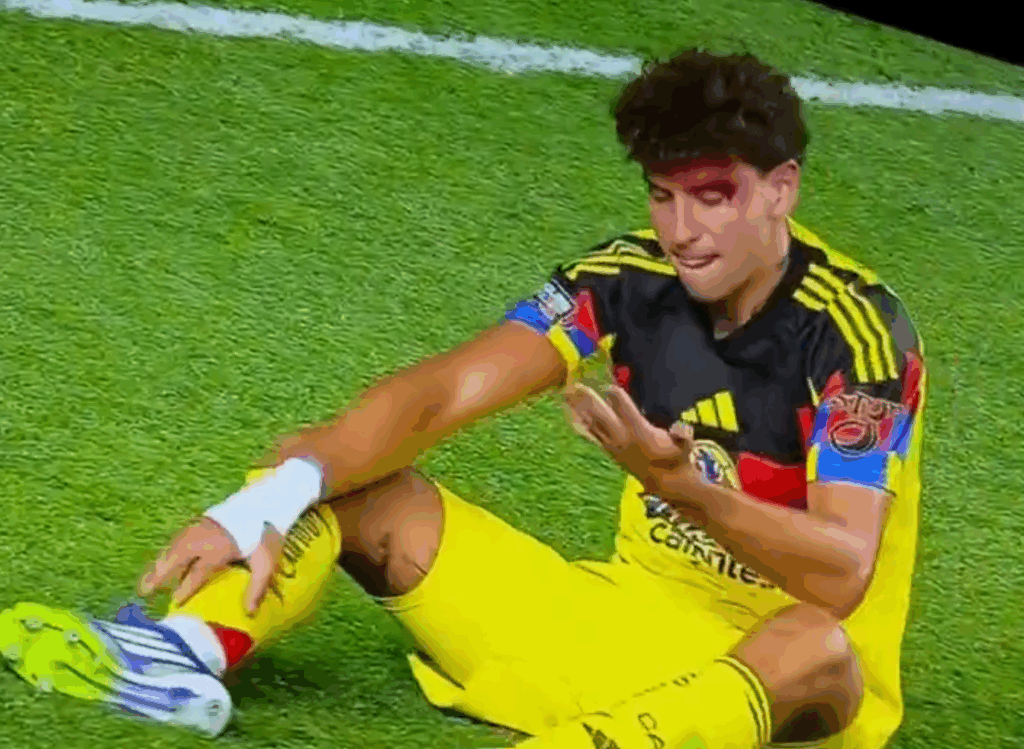 Tremenda herida de Igor Lichnovsky. | Foto print: Apple TV