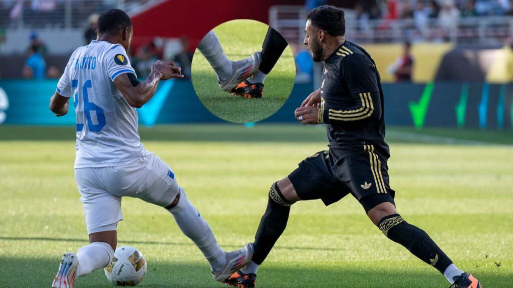 Alexis Vega sufrió una entrada bastante agresiva de Luis Crisanto, defensa lateral derecho de Honduras, que casi lo rompe