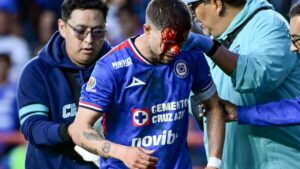 Nacho Rivero podría estar en la convocatoria de Cruz Azul pese a los 12 puntos de sutura