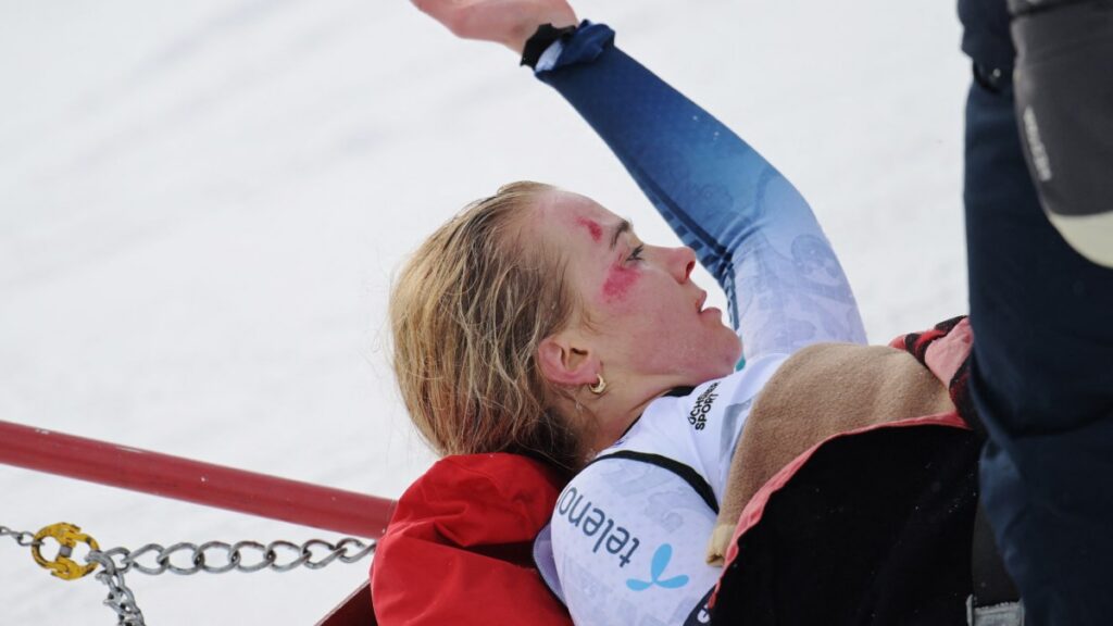 Los médicos atendieron rápidamente a Monsen, de 26 años: tenía el rostro muy marcado alrededor de la nariz, la boca y el ojo derecho.