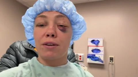 Rose Namajunas se somete a cirugia ocular tras UFC 324: estará tres meses fuera