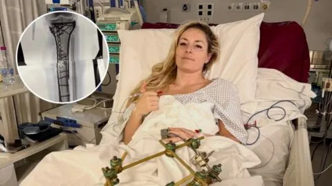 Lindsey Vonn confirma que su última cirugía fue exitosa tras más de seis horas en quirófano