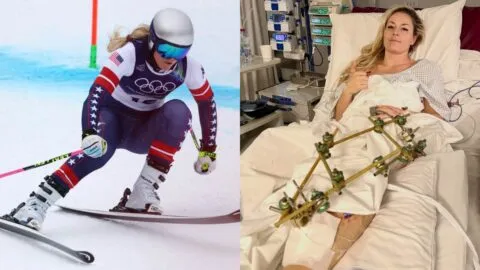 Lindsey Vonn comienza su recuperación: "Sin duda, son tiempos difíciles, pero sigo agradecida"