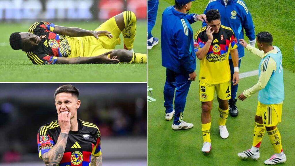 América, lista de lesionados para la vuelta contra Pumas