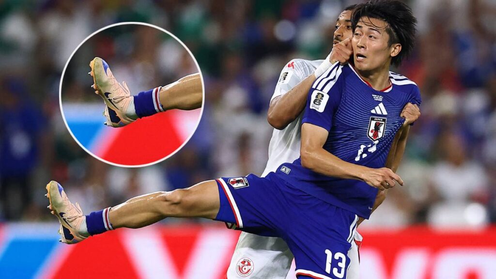 Nakamura ha sido tendencia en redes debido a su singular forma de usar el uniforme japonés con lo que parece que no trae espinilleras