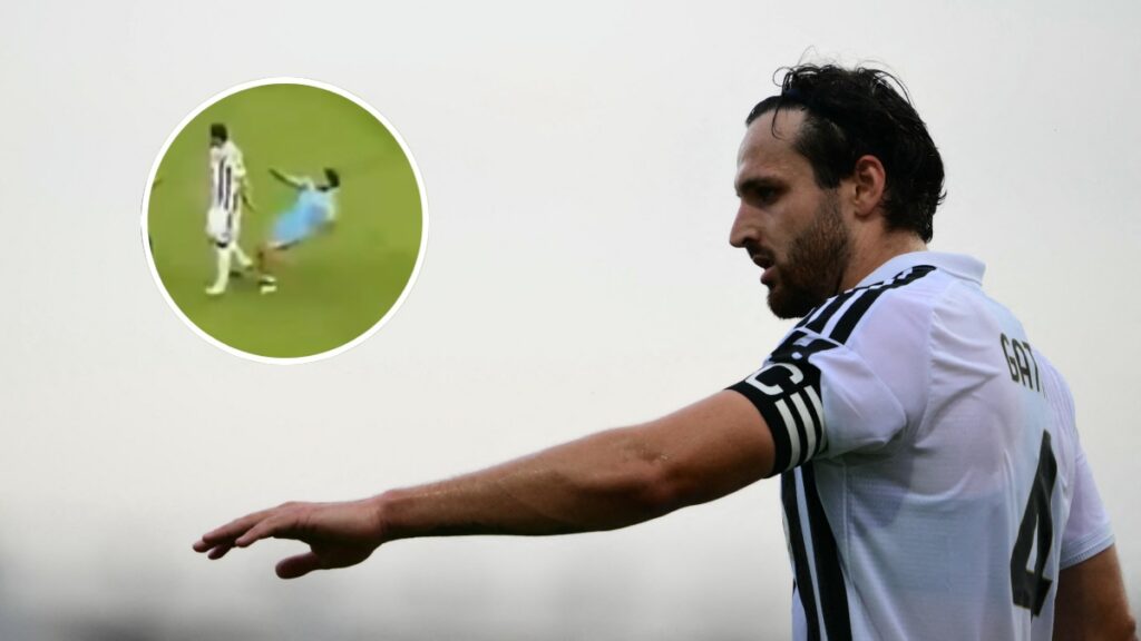 Lesión Juventus