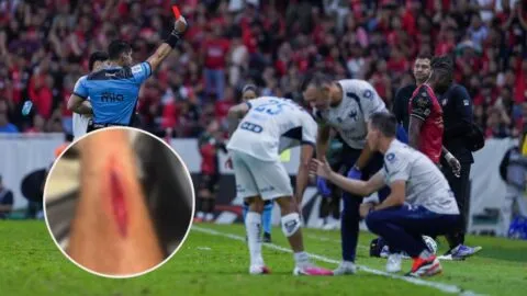 ¡Escalofriante! Orbelín Pineda muestra la herida que sufrió ante Atlas