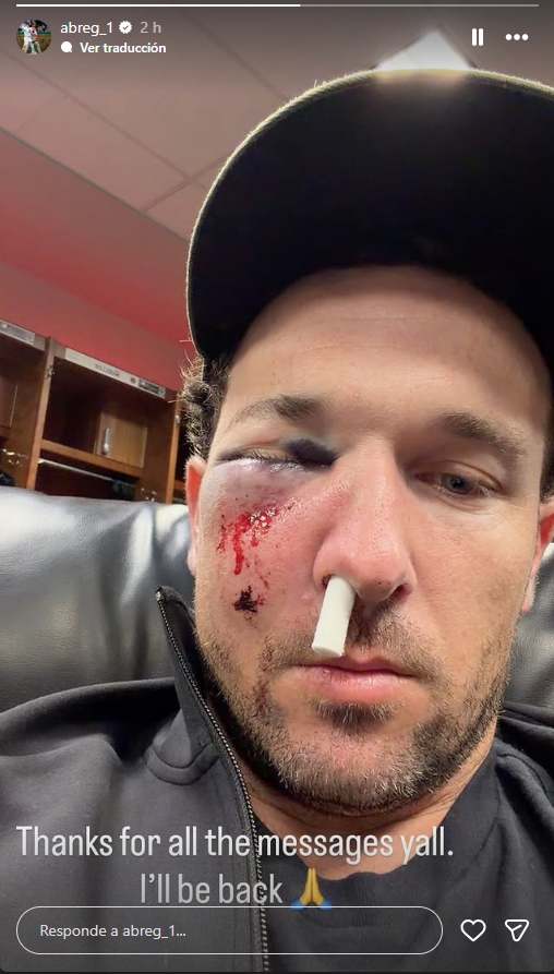 Alex Bregman después del pelotazo