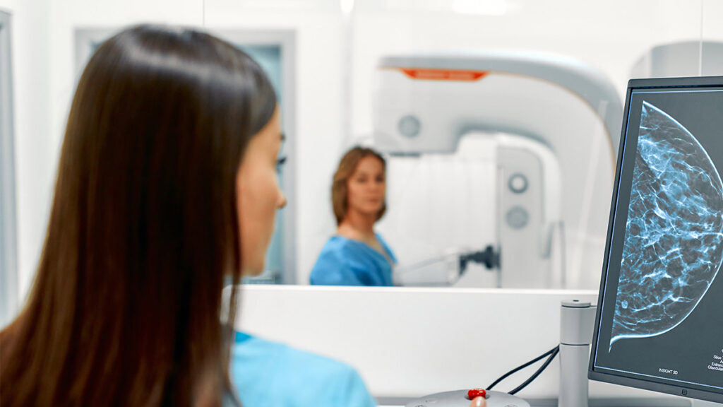 cáncer de mama inteligencia artificial