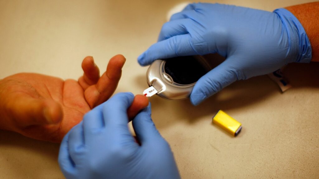 Diabetes Contro Unam Correcto Tres De Diez