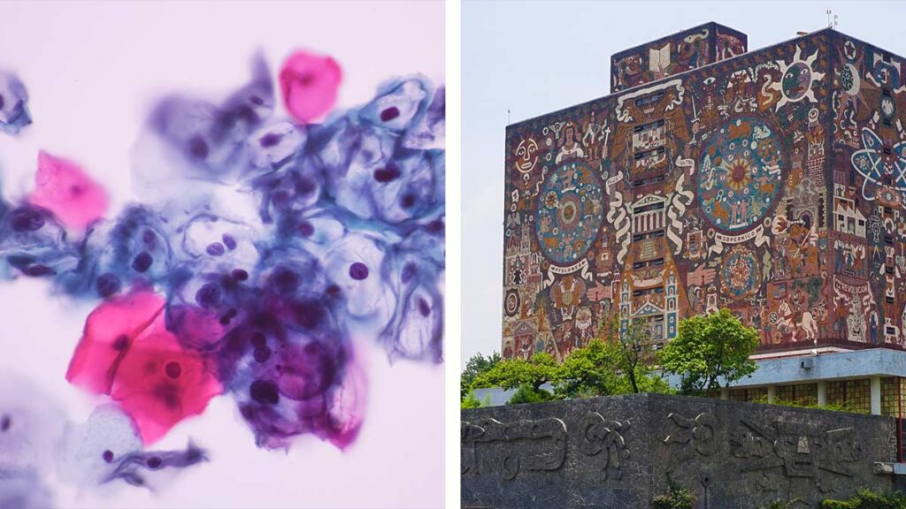 biosensor para detectar el virus del papiloma humano