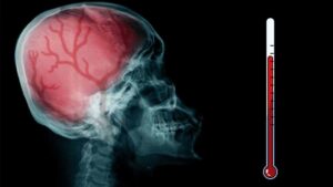 Brote "sin precedentes" de meningitis afecta a Reino Unido, reportan dos muertos