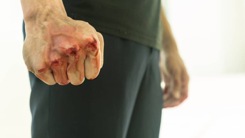 Golpean a periodista