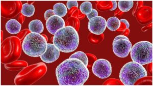 México avanza contra la leucemia con terapia CAR-T