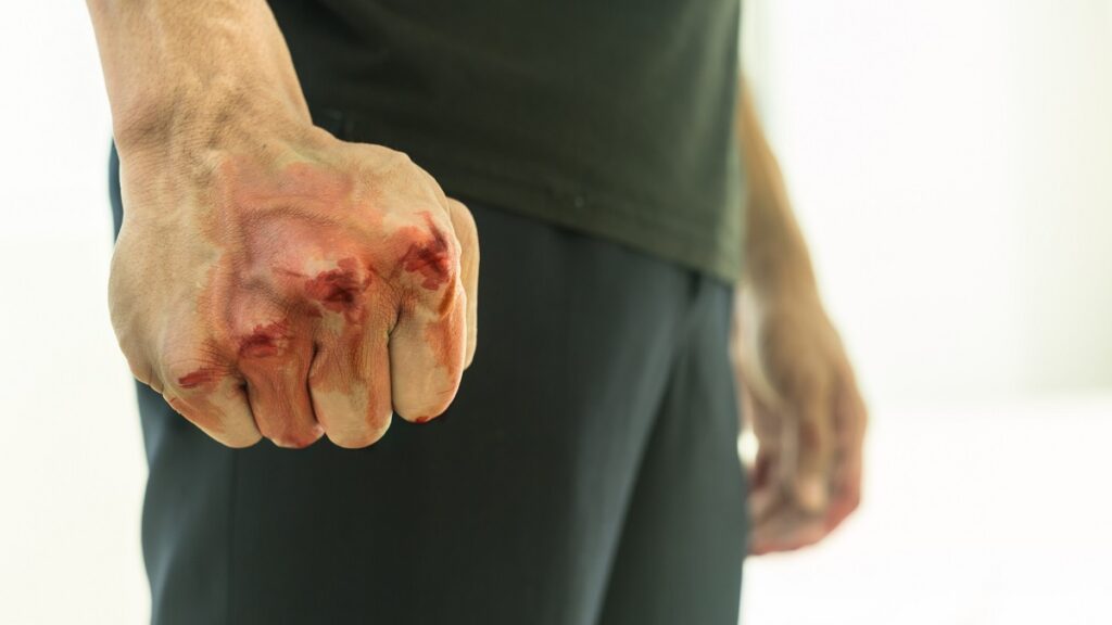 hombre golpea a viejito por atropellar a su perro