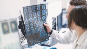 El caso más joven de alzheimer diagnosticado: es un hombre de 19 años en China