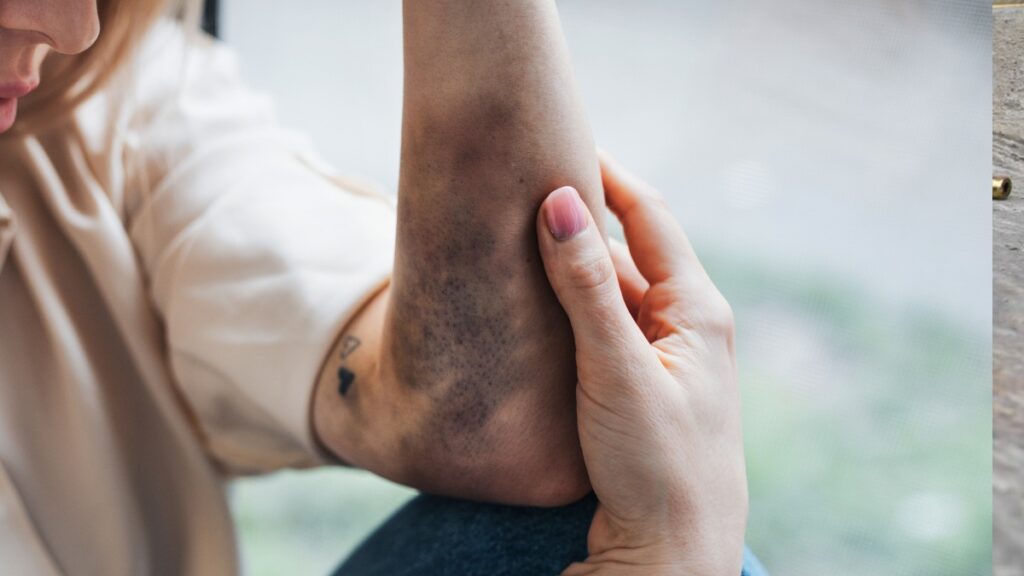 golpea a su cita porque le dijo que uso mucha ia