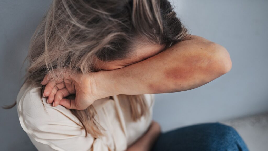 Colegio de Notarios de Colima condena violencia cometida por uno de sus miembros al golpear a una mujer