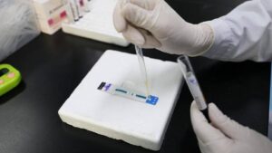 PEP: Una herramienta clave para frenar el VIH en China