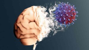 Virus intestinal podría causar un tipo de Alzheimer: estudio