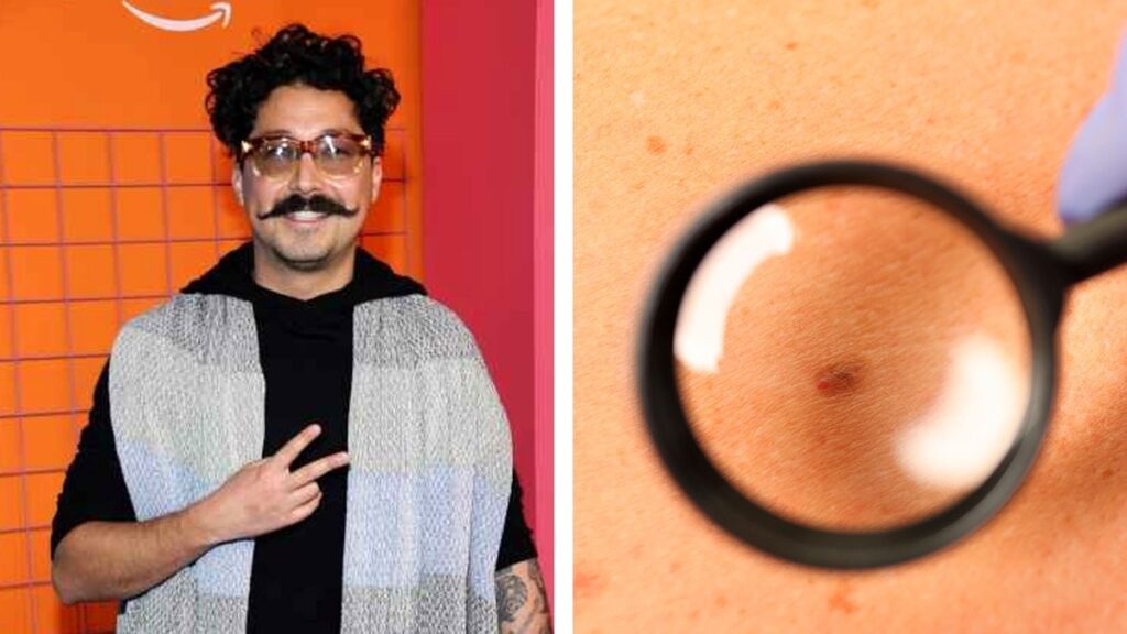 Mau Nieto revela que tiene cáncer de piel y cuenta cómo su esposa lo detectó