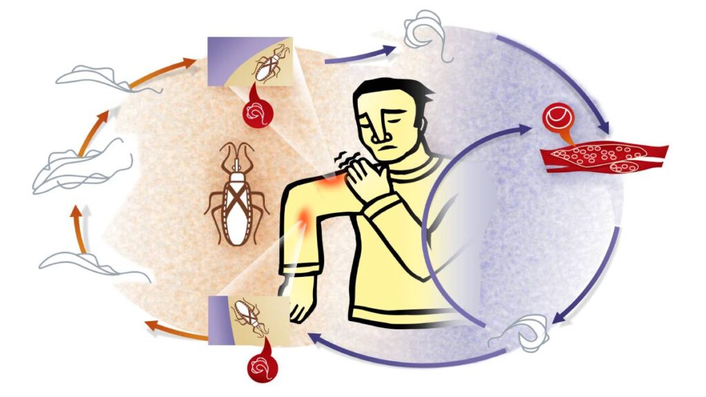 Mexicanos detectan etapas de la enfermedad de Chagas con IA: ¿cómo afecta?