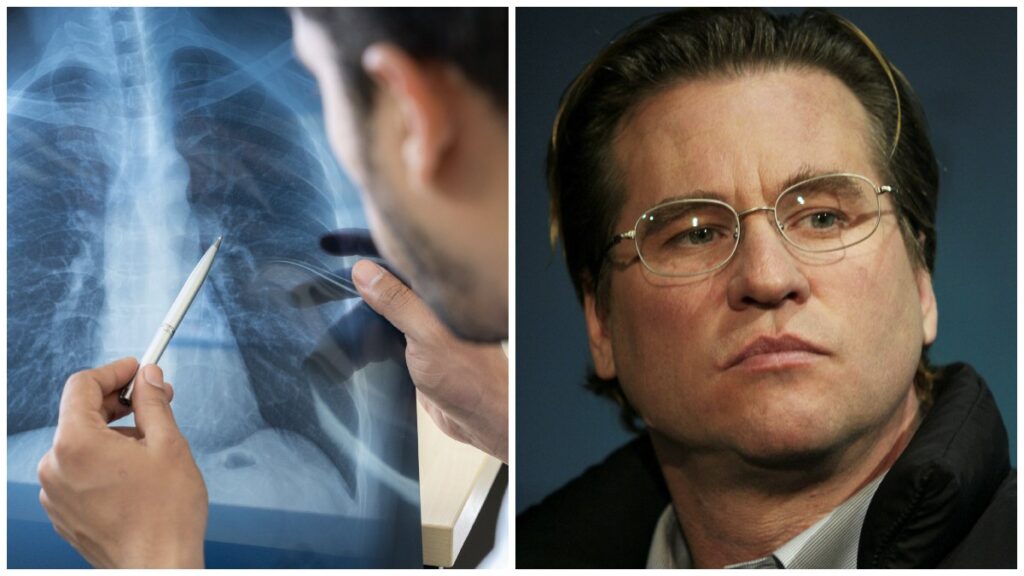 Val Kilmer falleció a los 65 años por neumonía