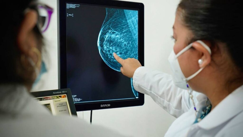 CÁNCER DE MAMA