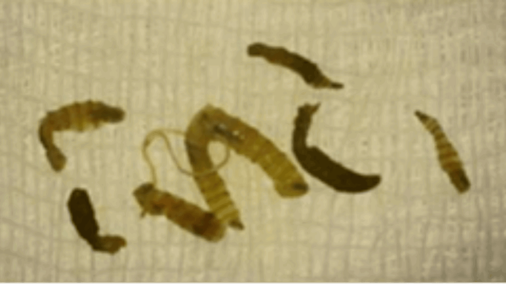 Se registra nuevo caso humano de gusano barrenador en Yucatán.