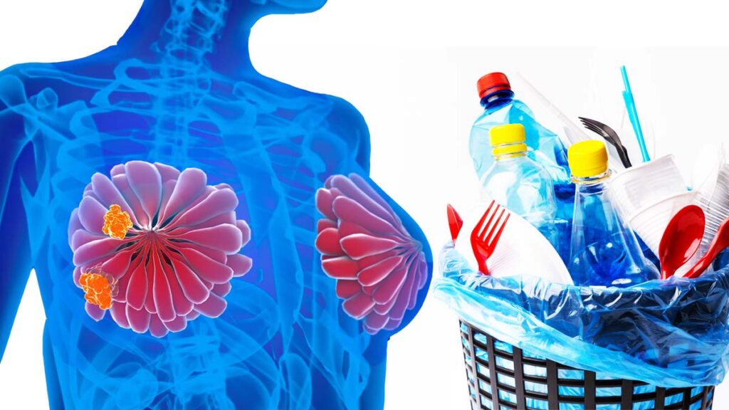 Plasticos Cancer De Mama