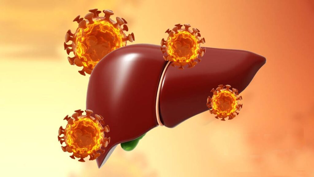 Casos De Hepatitis B En Mexico
