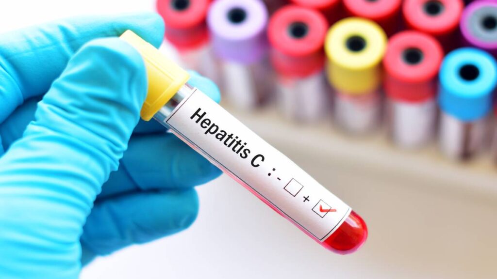 México en Top 5 mundial por muertes de cirrosis ligadas a hepatitis C