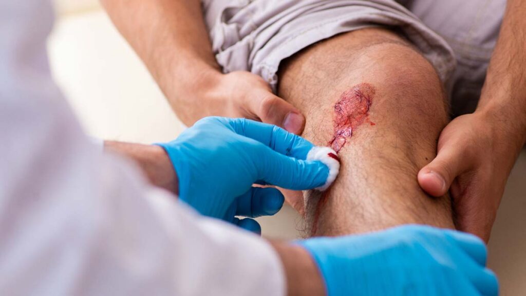 Primeros Auxilios Cortaduras