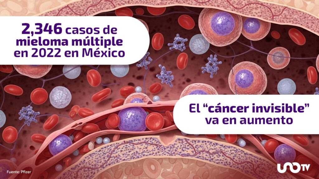 Mieloma múltiple, un problema con muchos retos en México