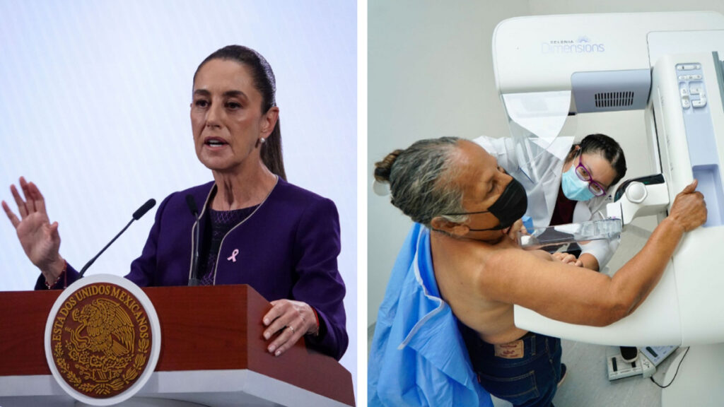 ¿Cómo funcionará el Modelo Universal de Cáncer de Mama?