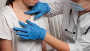 Sarampión, “supergripe” y otros brotes de 2025 que aún no han sido contenidos