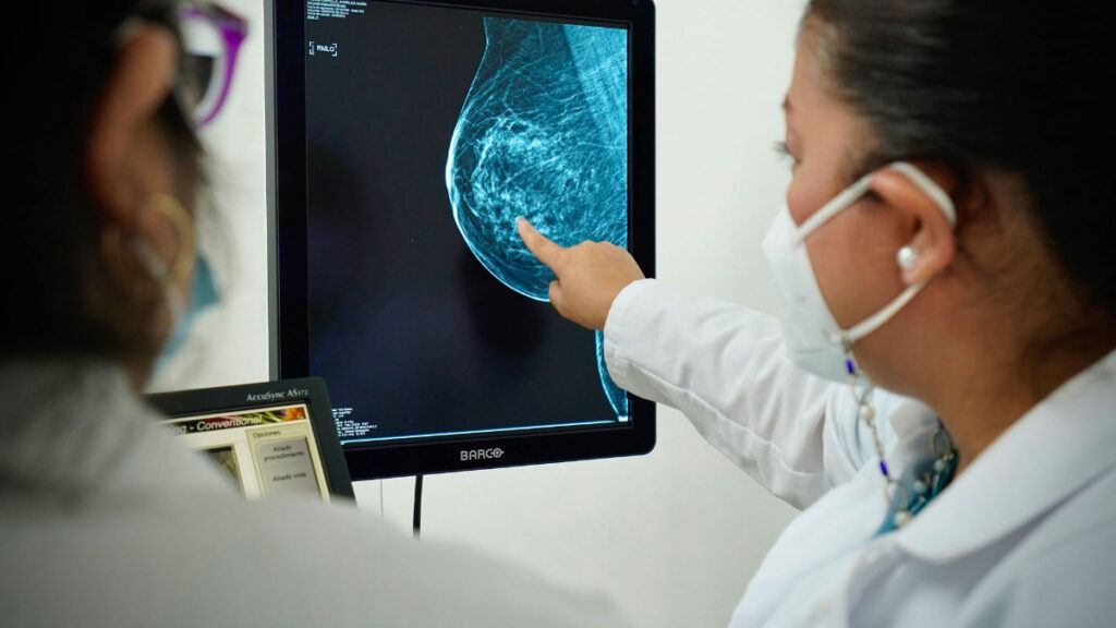 Lugares para hacerte una mastografía de manera gratuita