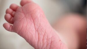 Cierran centro de salud en Zacatecas tras quemaduras a recién nacida