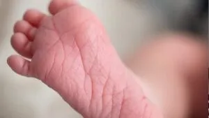 Cierran centro de salud en Zacatecas tras quemaduras a recién nacida