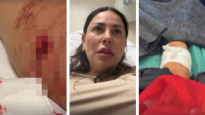 Gaby Ramírez fue hospitalizada con la pierna “destrozada” tras ataque de perro: fuertes imágenes