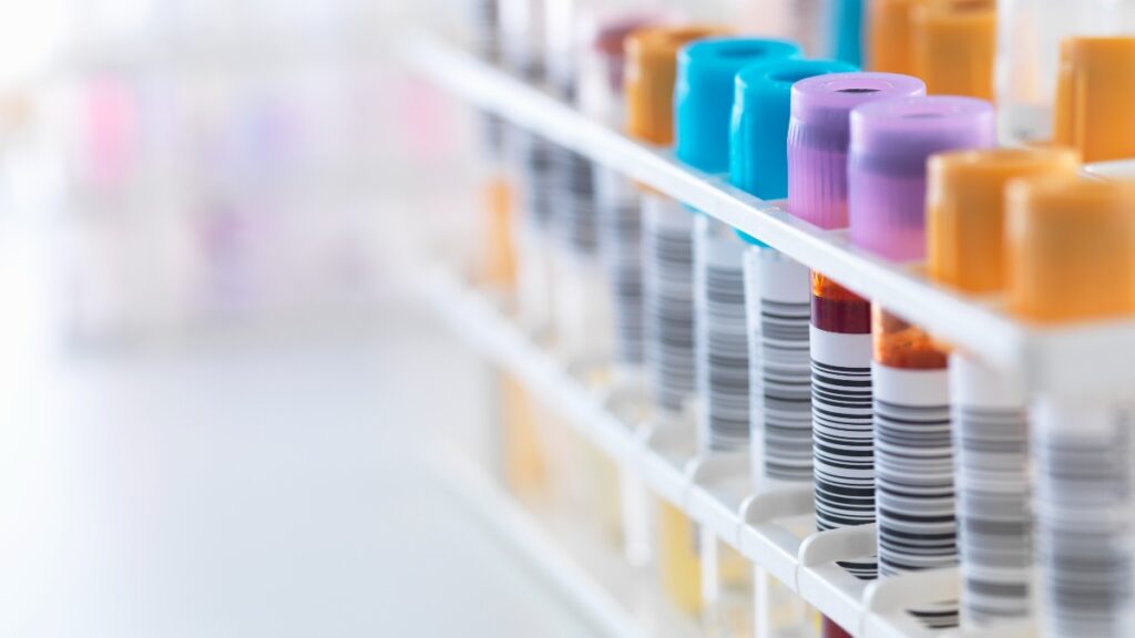 Buscan voluntarios para estudio de diabetes y su relación con el hígado graso; ve detalles