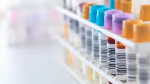 Buscan voluntarios con diabetes tipo 2 para estudio sobre hígado graso en México