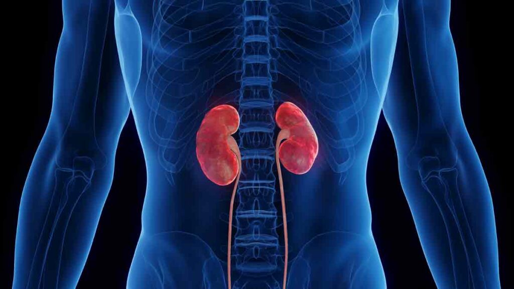 ERC es de las principales enfermedades en México