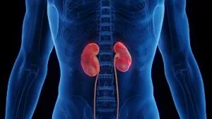 México entre los países con más casos de enfermedad renal crónica en el mundo