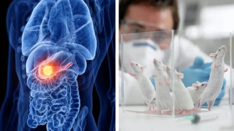 Científicos españoles logran eliminar por completo tumores de páncreas en ratones