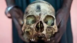 Canibalismo: la “risa mortal", la extraña enfermedad relacionada con comer carne humana