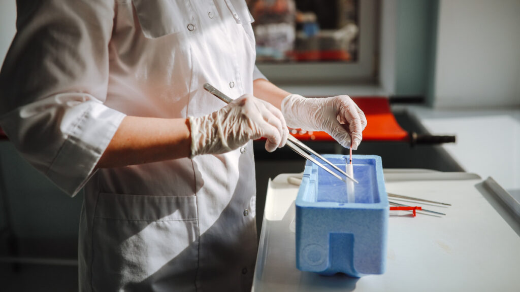 ¿Es posible solucionar la infertilidad con inteligencia artificial?