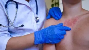 Aumentan a 26 los casos de sarampión en Baja California