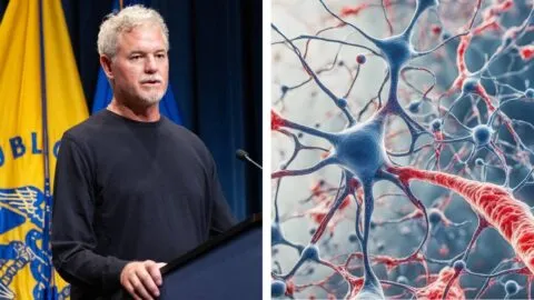 ¿Qué es la esclerosis lateral amiotrófica (ELA), la enfermedad que padecía Eric Dane?